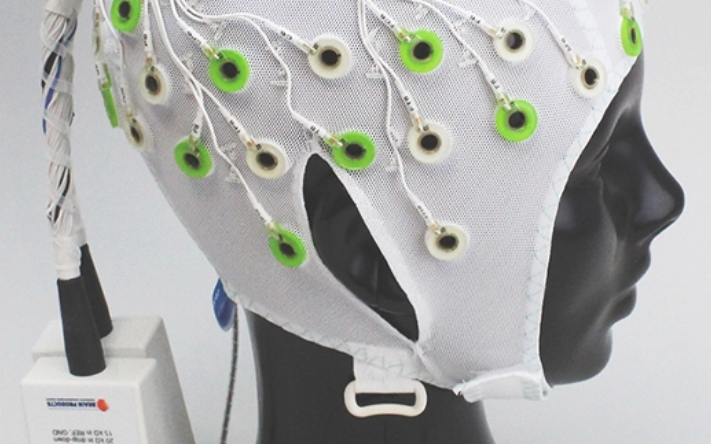 EEG Record